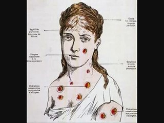 Prostitution and White Slavery in the Early 20th Century