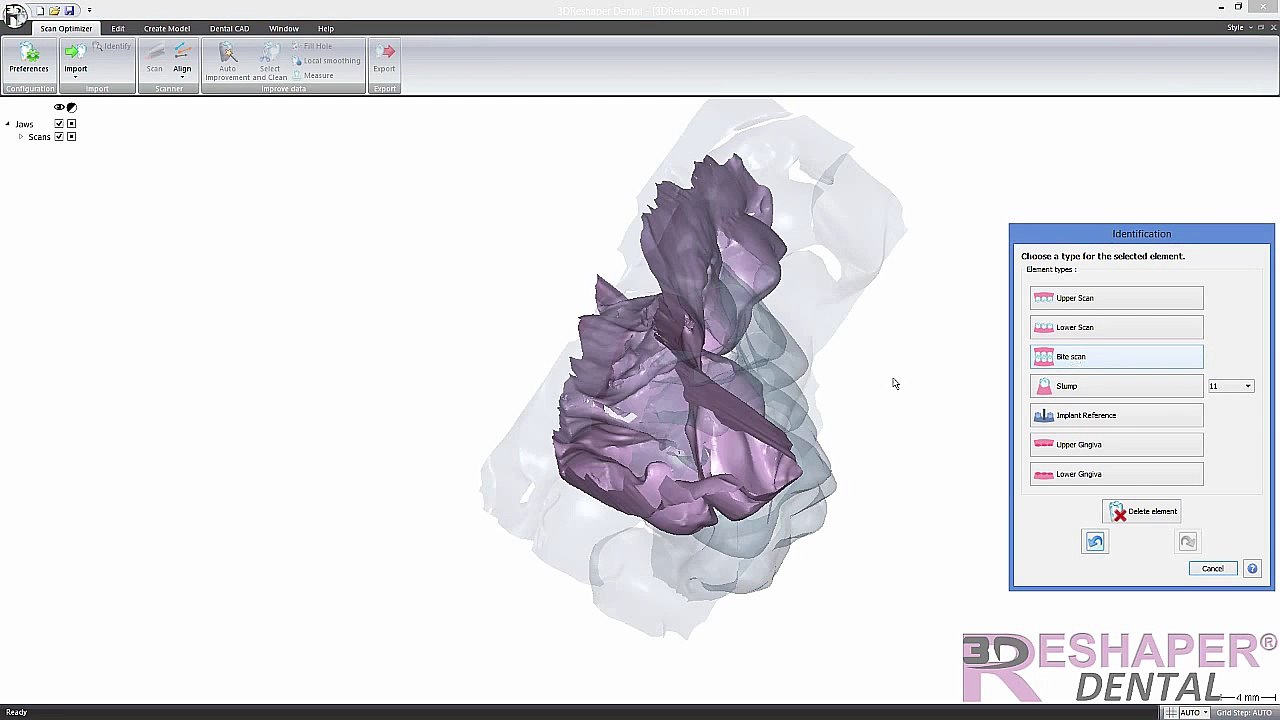 3DReshaper Dental Initial - STL Optimizer (10-2014)