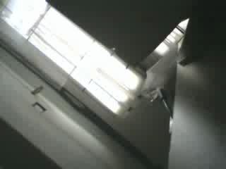 My hands after parkour (simple)