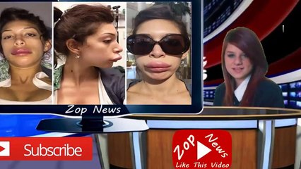 Farrah Abraham's Lip Injections Went Horribly Wrong