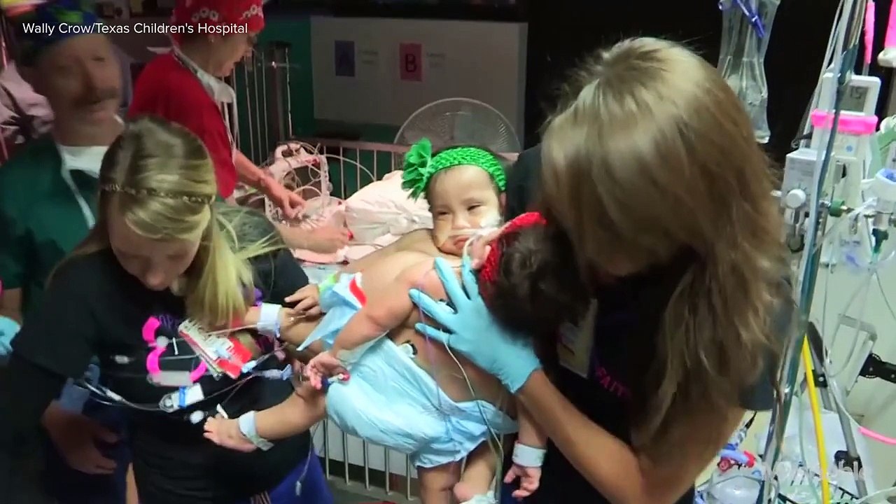 Conjoined twins survive 26-hour separation surgery - Mashable