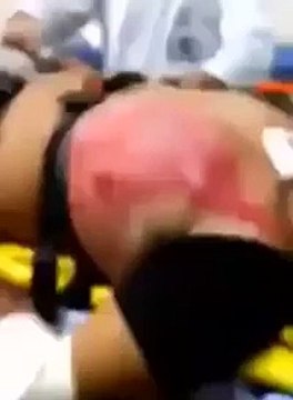 24 Tane Enerji İçeceği İçen Adamın Kalbi Çıkacak