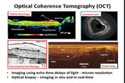 Biomedical Imaging with Optical Coherence Tomography - James Fujimoto