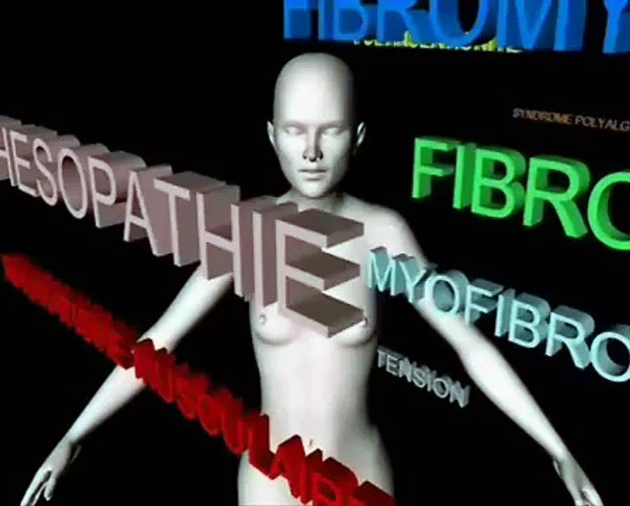 La fibromyalgie