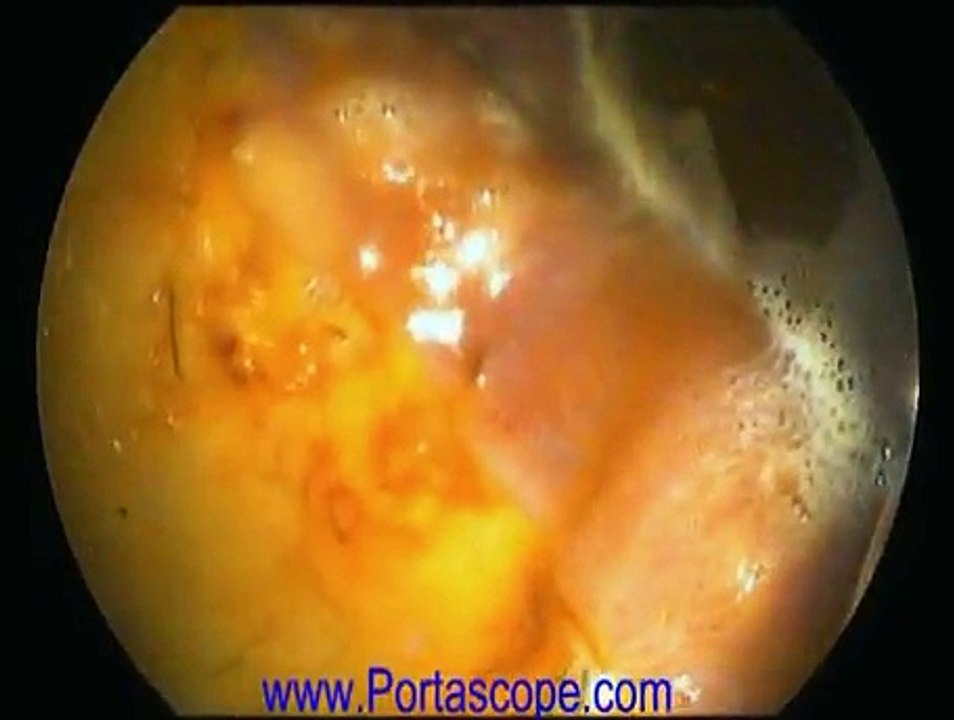 Equine Endoscopy Endoscope using a PVS3M PortaScope