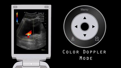 Introduction to Vscan Portable Ultrasound Device
