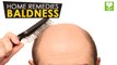 Baldness - Home Remedies | Health Tone Tips