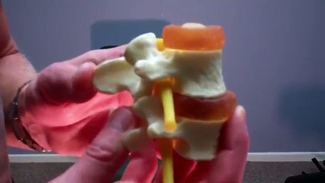 Gohl Clinic of Chiropractic - Neck Adjustment - Gonstead Cervical Chair C7