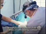 Mohs micrographic surgery skin cancer treatment basal cell carcinoma squamous cell melanoma