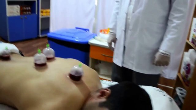 HACAMAT NEDİR NASIL YAPILIR VAN HACAMAT VE SÜLÜK TEDAVİ MERKEZİ 0532 172 15 66