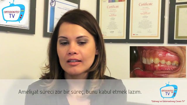 Çene Ameliyatı Nasıl Bir Süreçtir? - Ortognatik Cerrahi Süreci - Çene Ameliyatı Olacak Hastaları Neler Bekliyor?
