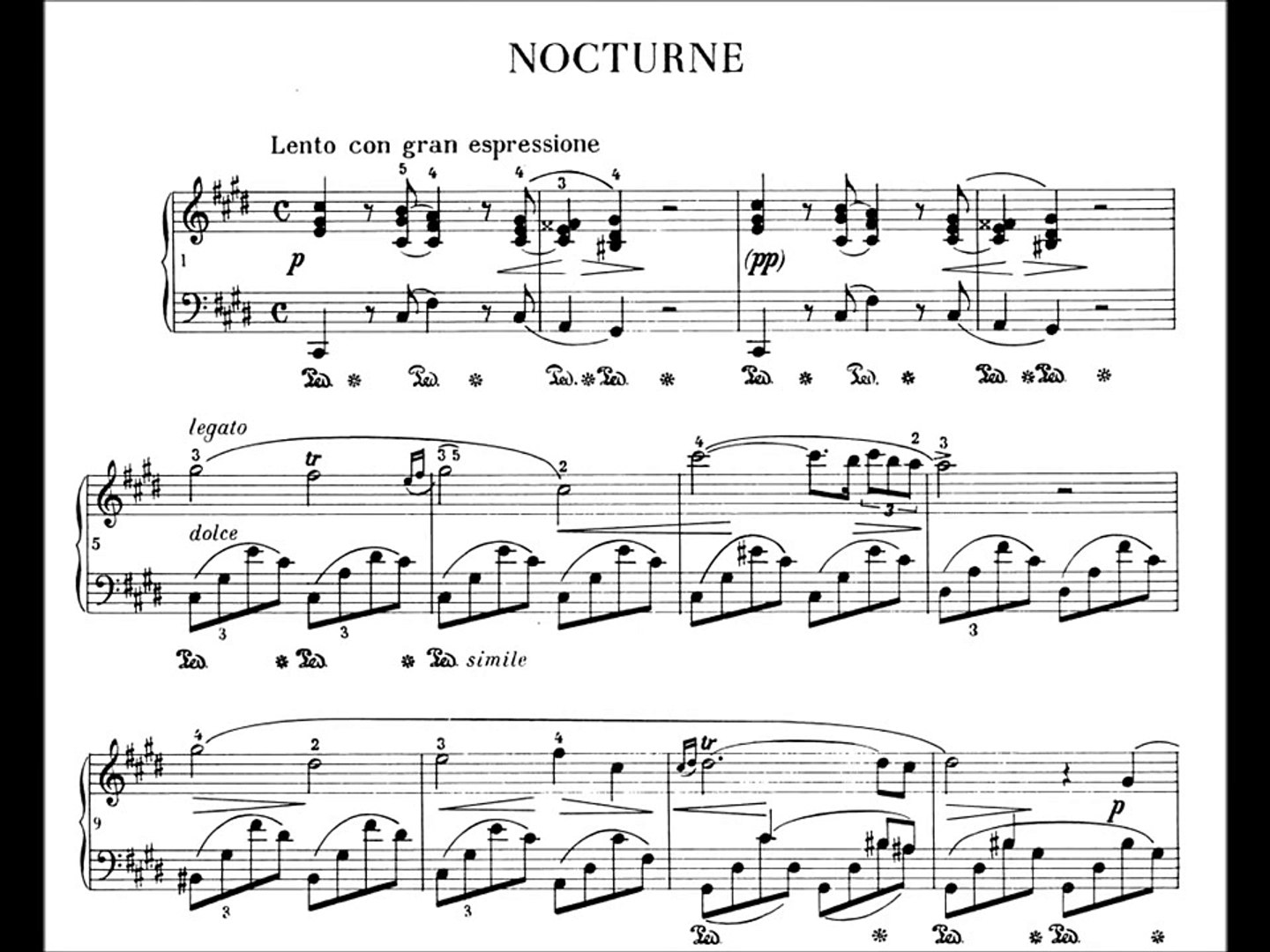 Chopin Nocturne Op 20 in C Sharp minor - video Dailymotion