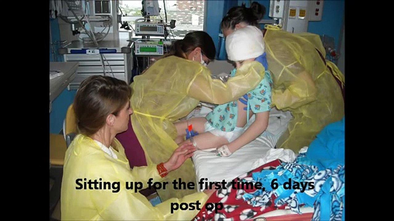 Candon's 3 year journey of Epilepsy and RE, and his Hemispherectomy cuRE.