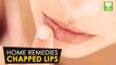 Chapped Lips - Home Remedies | Health Tone Tips