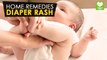 Diaper Rash - Home Remedies | Health Tone Tips