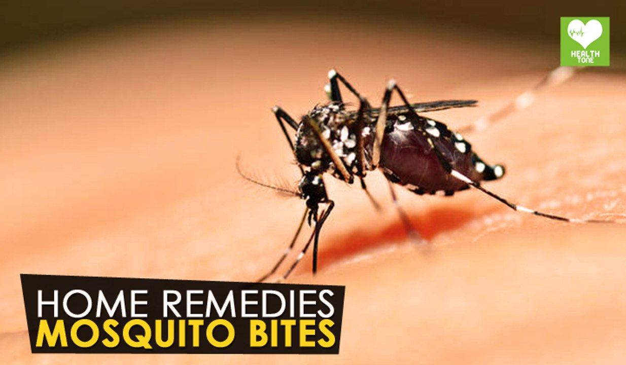 Mosquito Bites - Home Remedies | Health Tips