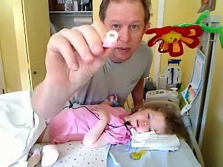 Spinal Muscular Atrophy - Shira Brushing Her Teeth