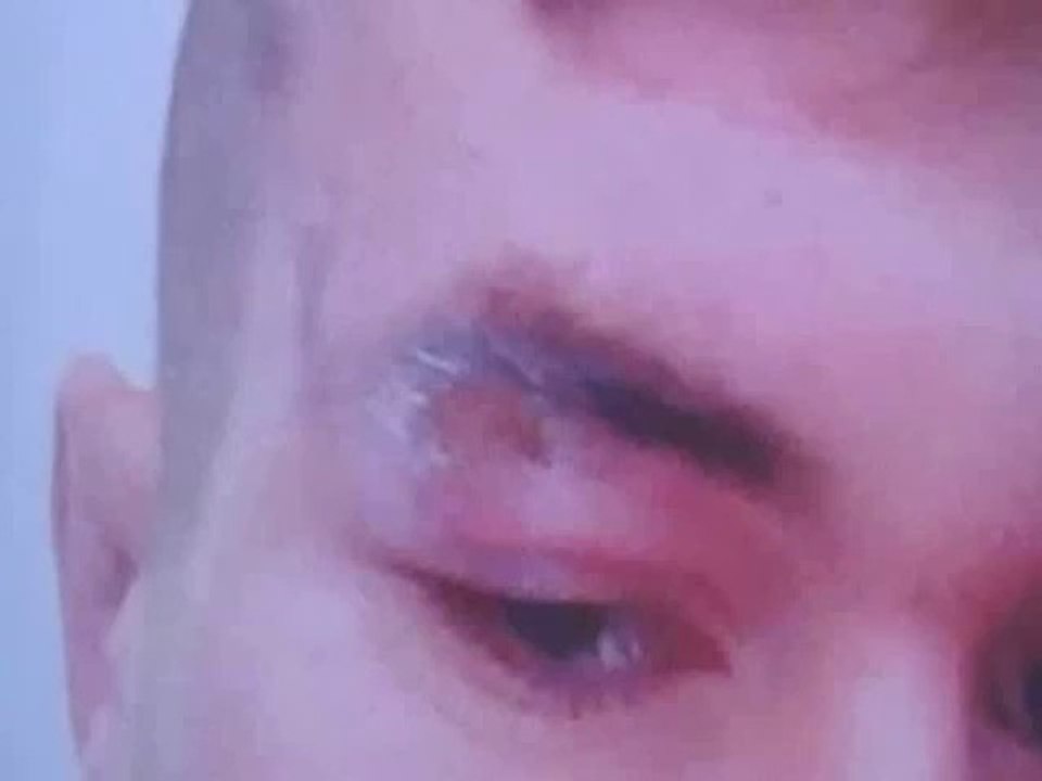 Horrific Injuries inflicted on Innocent man by Police officer - see description