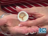 Rally for Red: Mayo Clinic experts talk aortic stenosis