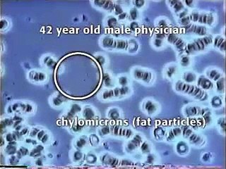 2.Live Blood Microscopy Demonstration. Blood Samples healthy or with parasites.