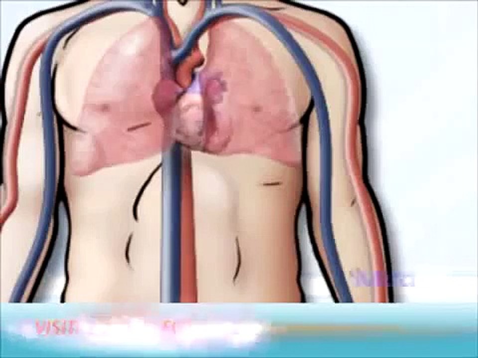 Types of Blood Vessels