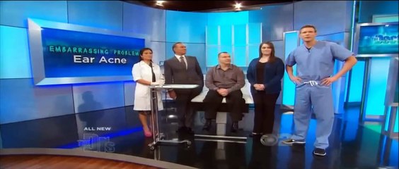 Blackhead Extraction Close Up: Blackhead Popping in Ear!