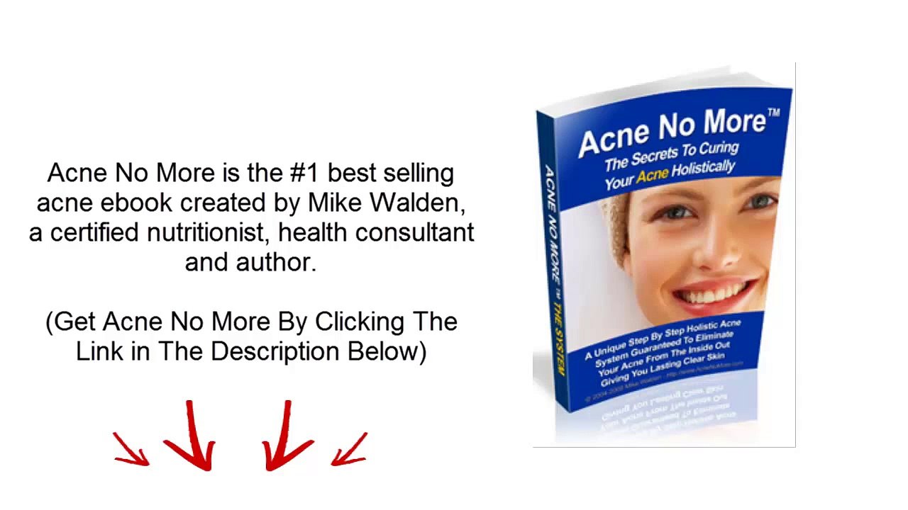 Acne No More Review - MUST WATCH!