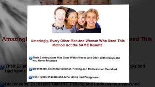 How To Get Rid Of Acne Naturally _ Best Acne No More Review