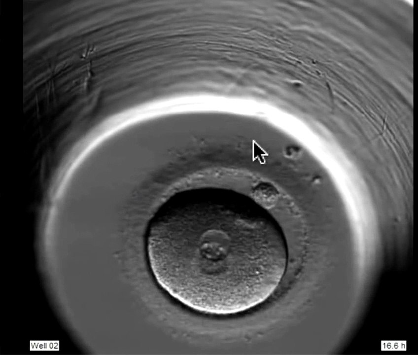 ivf embryo developing over 5 days by fertility Dr Raewyn Teirney