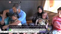 أب سوري يروي مأساة إصابة أطفاله بحروق بسبب البراميل المتفجرة