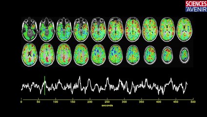 CERVEAU. Nouvelle technique pour visualiser les comportements