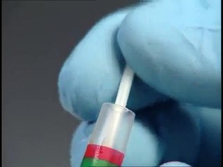 HX Diagnostics fluID Rapid Influenza Test