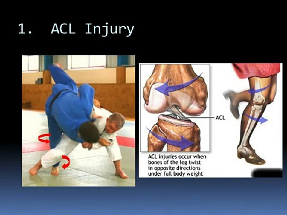 Common Judo Injuries