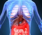 Colon cancer symptoms and information