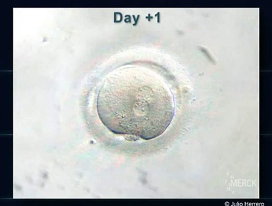 Fertilização in vitro - Reprodução Humana Assistida