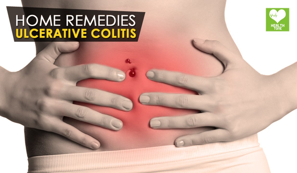 Ulcerative Colitis - Home Remedies | Health Tone Tips