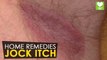 Jock Itch Treatment - Home Remedies | Health Tone Tips