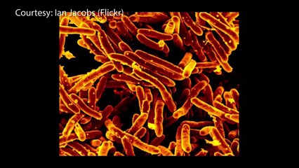 Trade and Migration Leave Border States Vulnerable To Infectious Disease