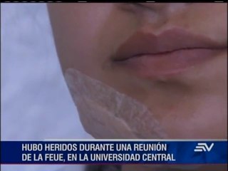 Se abre investigación sobre estudiantes agredidos en federación