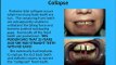 Dangers of Missing Teeth| Dental Implants|Glen Ellyn |(near Chicago)