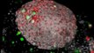Immune cells invade rejected pancreas