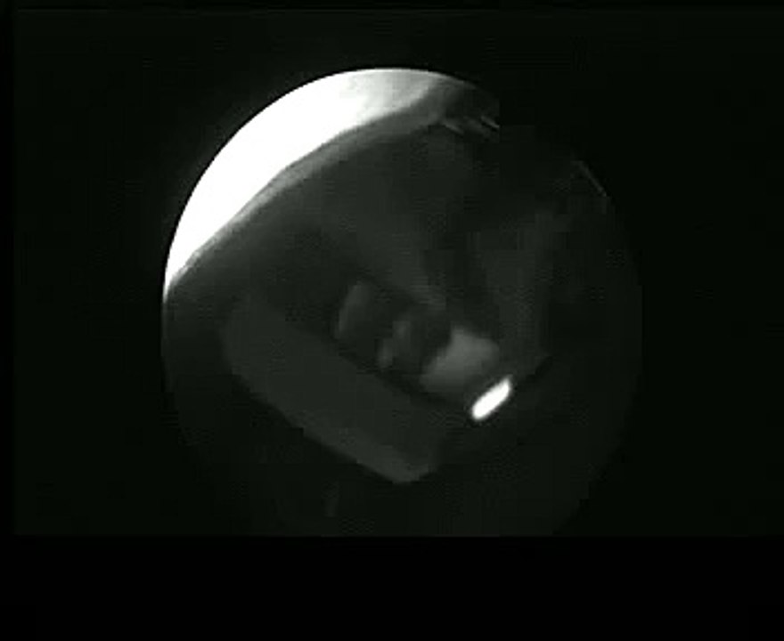 Gastroscopy in a dog with esophagitis www.en.endovet.su