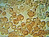 Human Blood on Microscope slide, primarily red blood cells, occasional white