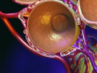 Bronchiectasis Animation - What is Bronchiectasis? Video.mp4