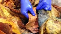 Cadaver Anatomy- organs