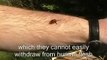The Sting - how a bee can remove its sting from human flesh (if you let it!)