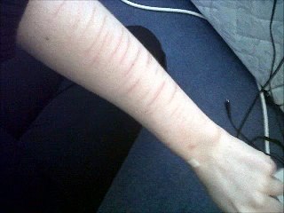 Self harm my story (TRIGGERING)