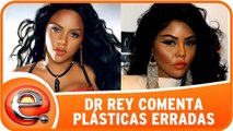 Dr. Rey comenta plásticas que deram errado