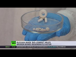 ‘It was like a miracle’: Russian scientists create ‘bio-cement’ for human bones