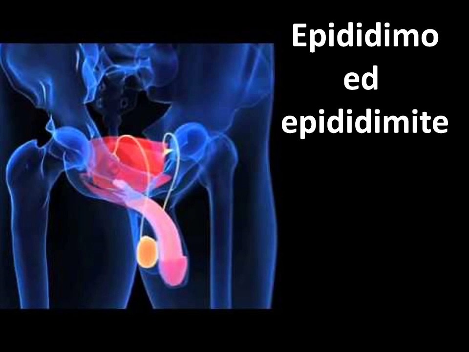 Epididimo ed epididimite, testicolo gonfio e dolente. Video Urologia. Urologo a Roma.